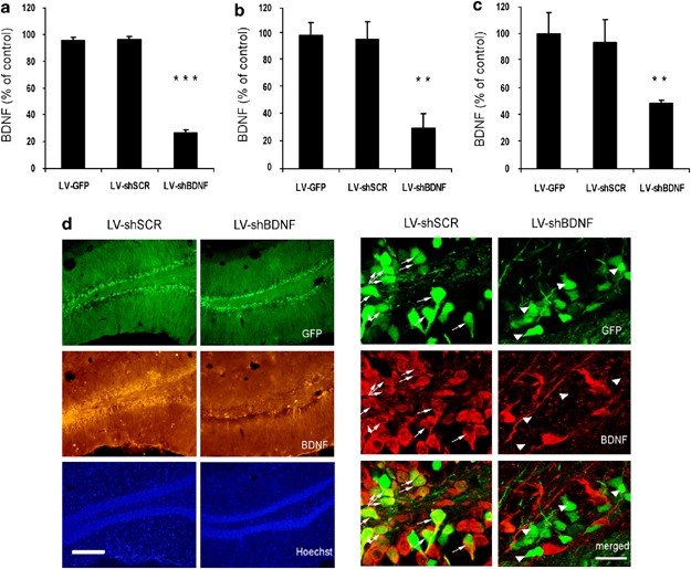 dihexa potency compared to bdnf synaptogenesis vs PE-22-28: Next-Generation Nootropic Peptides - Which Is Better? | PPW Dihexa shows neurotrophic activity exceeding