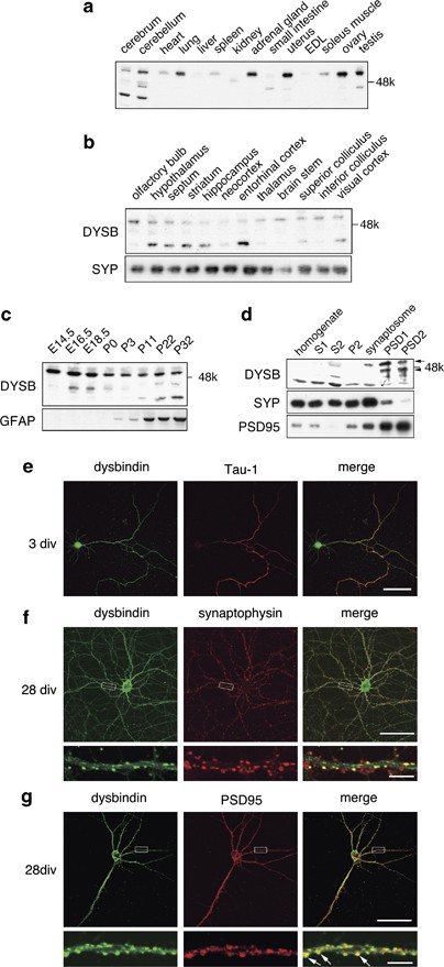 Dysbindin-1, WAVE2 and Abi-1 form a complex that regulates dendritic spine  formation | Molecular Psychiatry