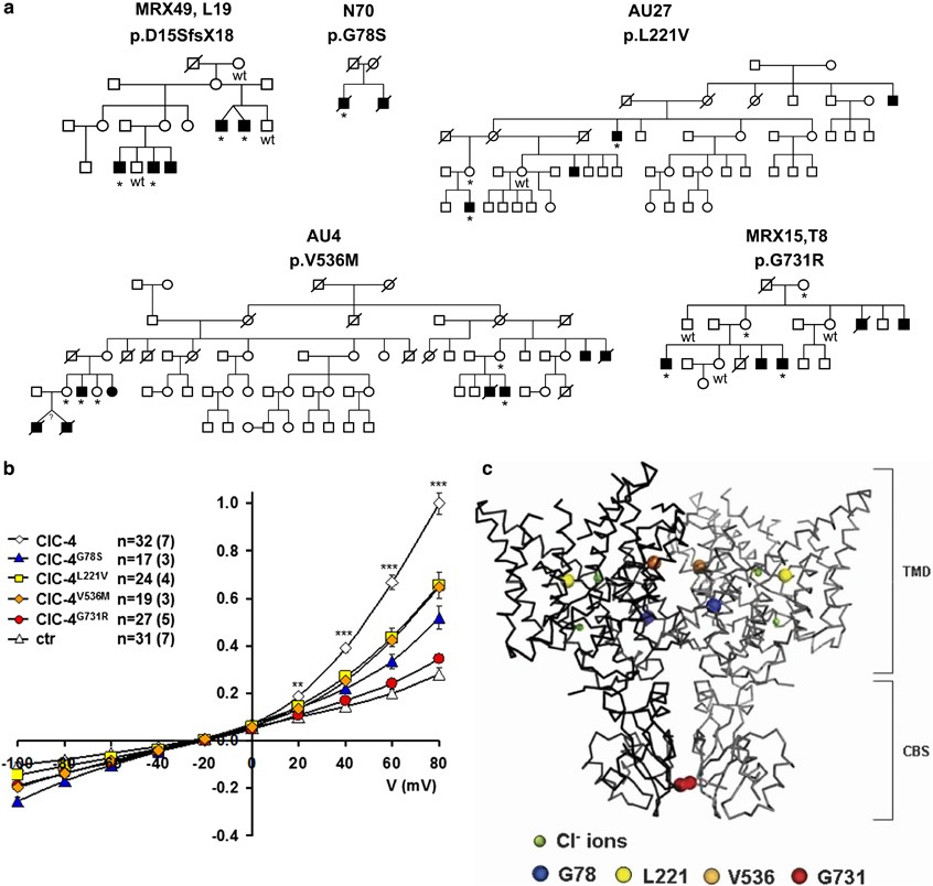 Cureus, Whole-Exome Sequencing Identified a Novel DYRK1A Variant in a  Patient With Intellectual Developmental Disorder, Autosomal Dominant 7