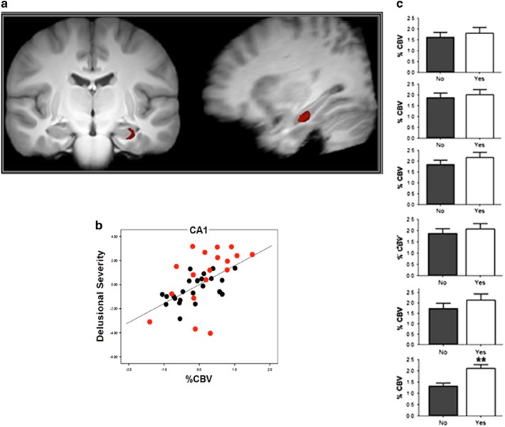 Hippocampal dysfunction in the pathophysiology of schizophrenia: a  selective review and hypothesis for early detection and intervention |  Molecular Psychiatry