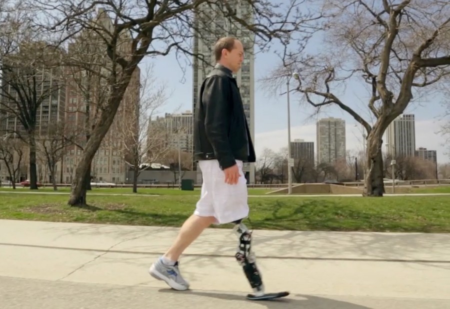 Rewired nerves control robotic leg | Nature