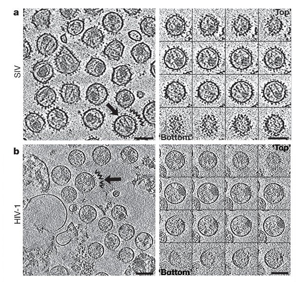 electron microscopy hiv