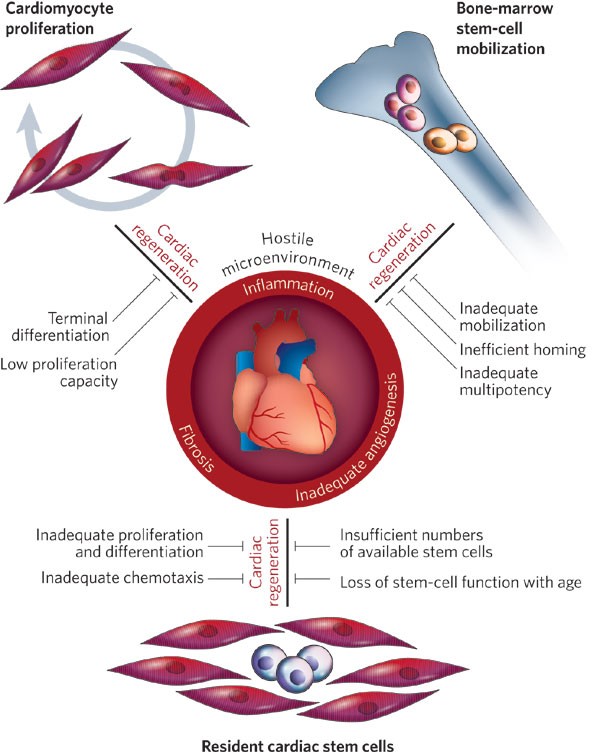 Innovative approach brings cell-reprogramming therapy for heart failure  closer to reality