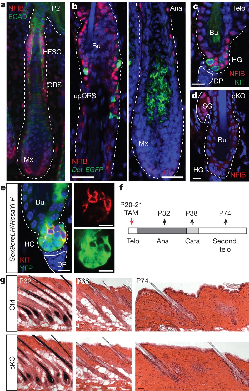 NFIB is a governor of epithelial–melanocyte stem cell behaviour in a shared  niche | Nature