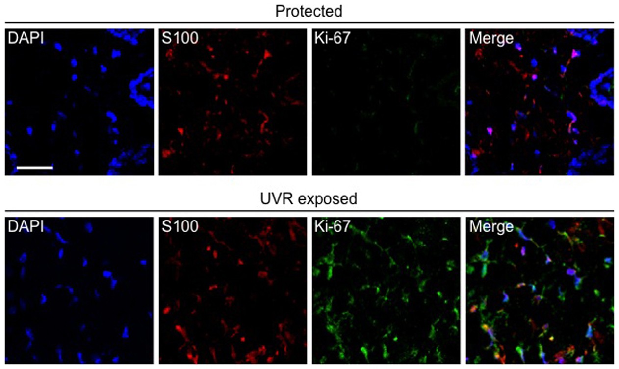 Extended Data Figure 2: UVR induced melanocytic proliferation in BRAF(V600E) mice.
