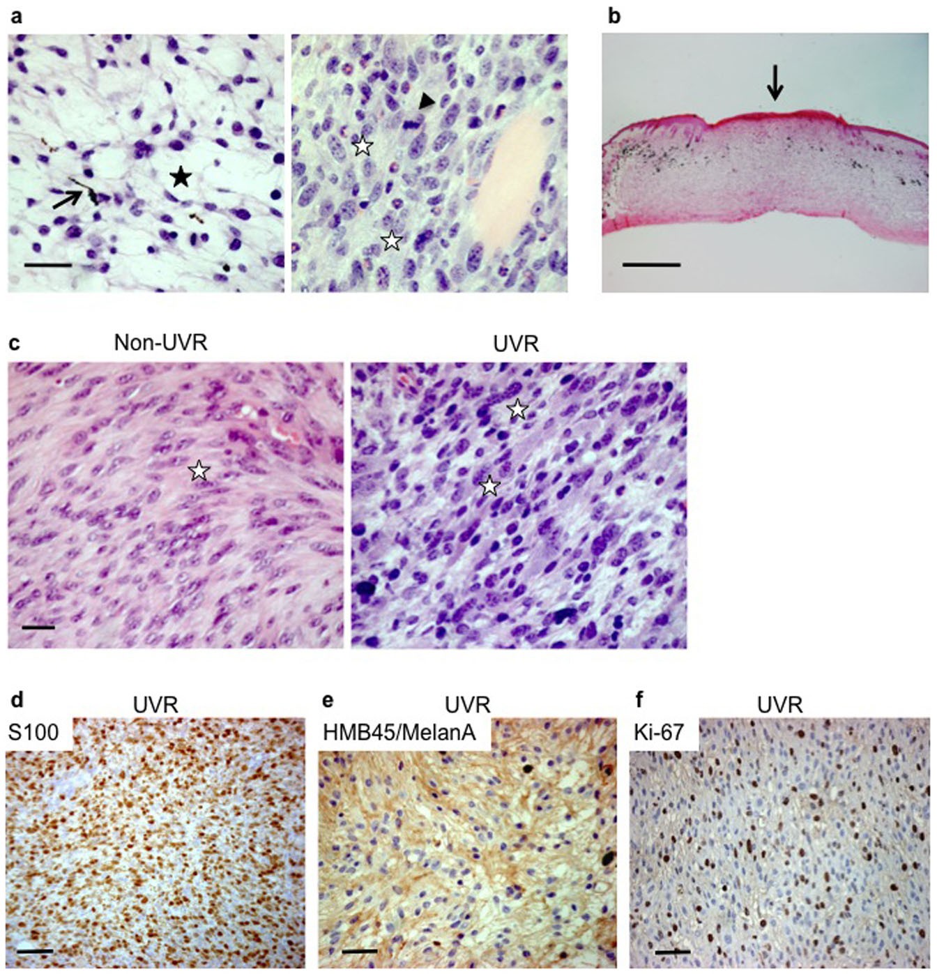 Extended Data Figure 4: UVR-accelerated BRAF(V600E)-driven tumours have similar histology to BRAF(V600E)-driven tumours from non-UVR-exposed animals.