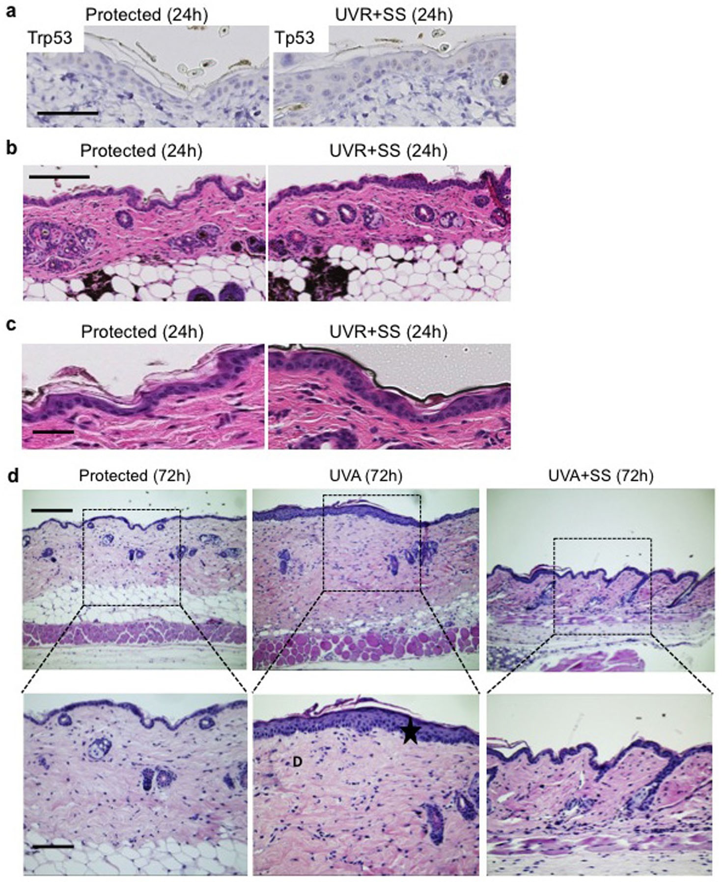 Extended Data Figure 5: Sunscreen blocks the short-term effects of UVR exposure.