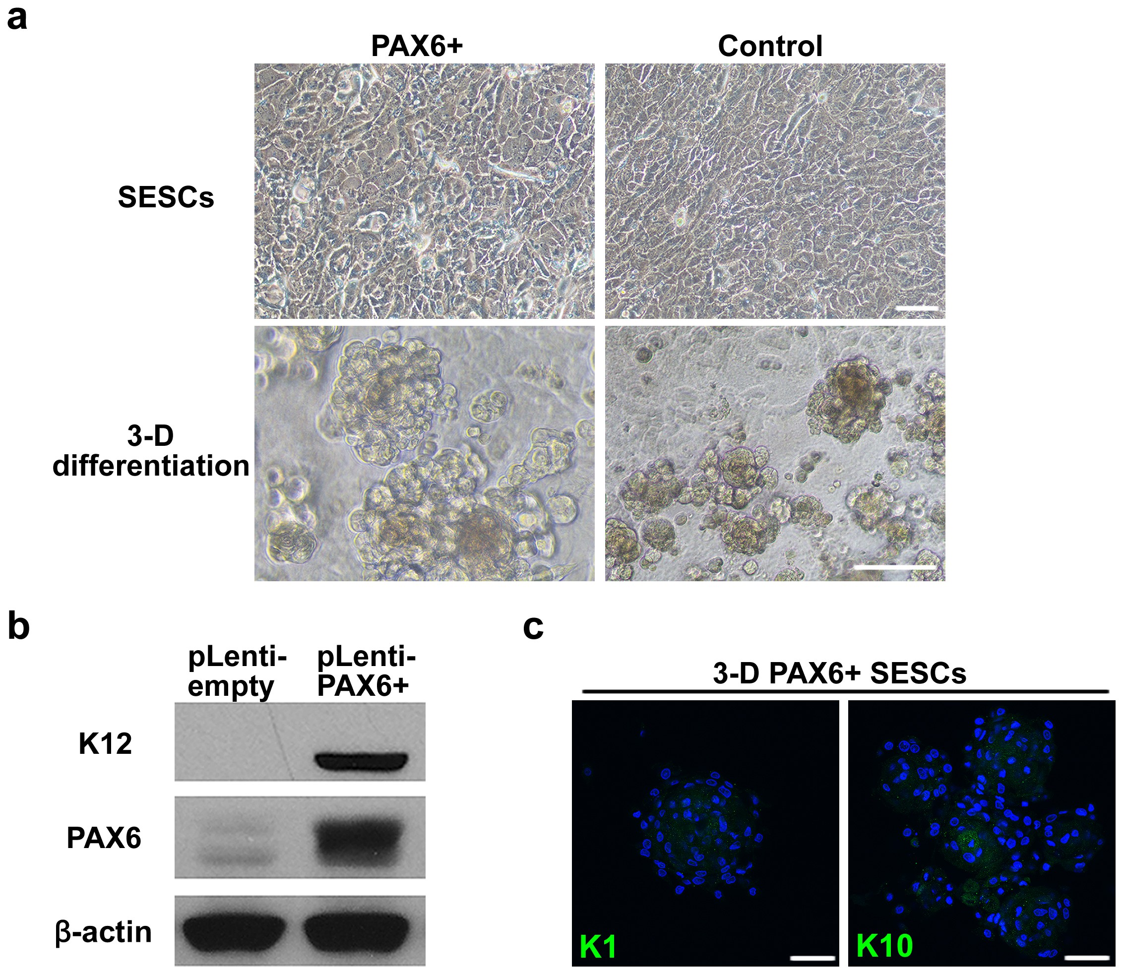 Extended Data Figure 5: The effect of PAX6 transduction in SESCs.