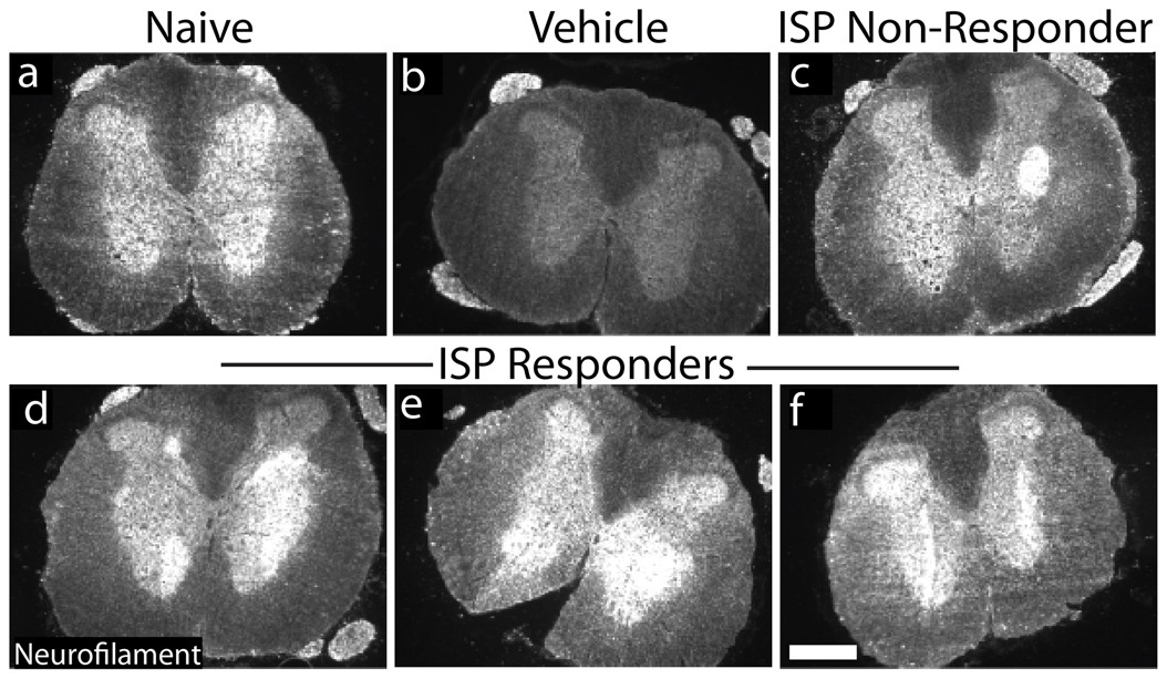 Extended Data Figure 10: Neurofilament staining at lumbar levels.