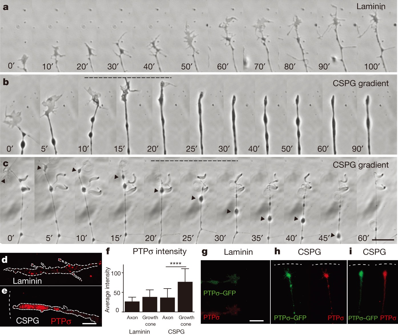 Spinal Cord Injury ICD 10: Unlocking the Power of Precision Diagnosis