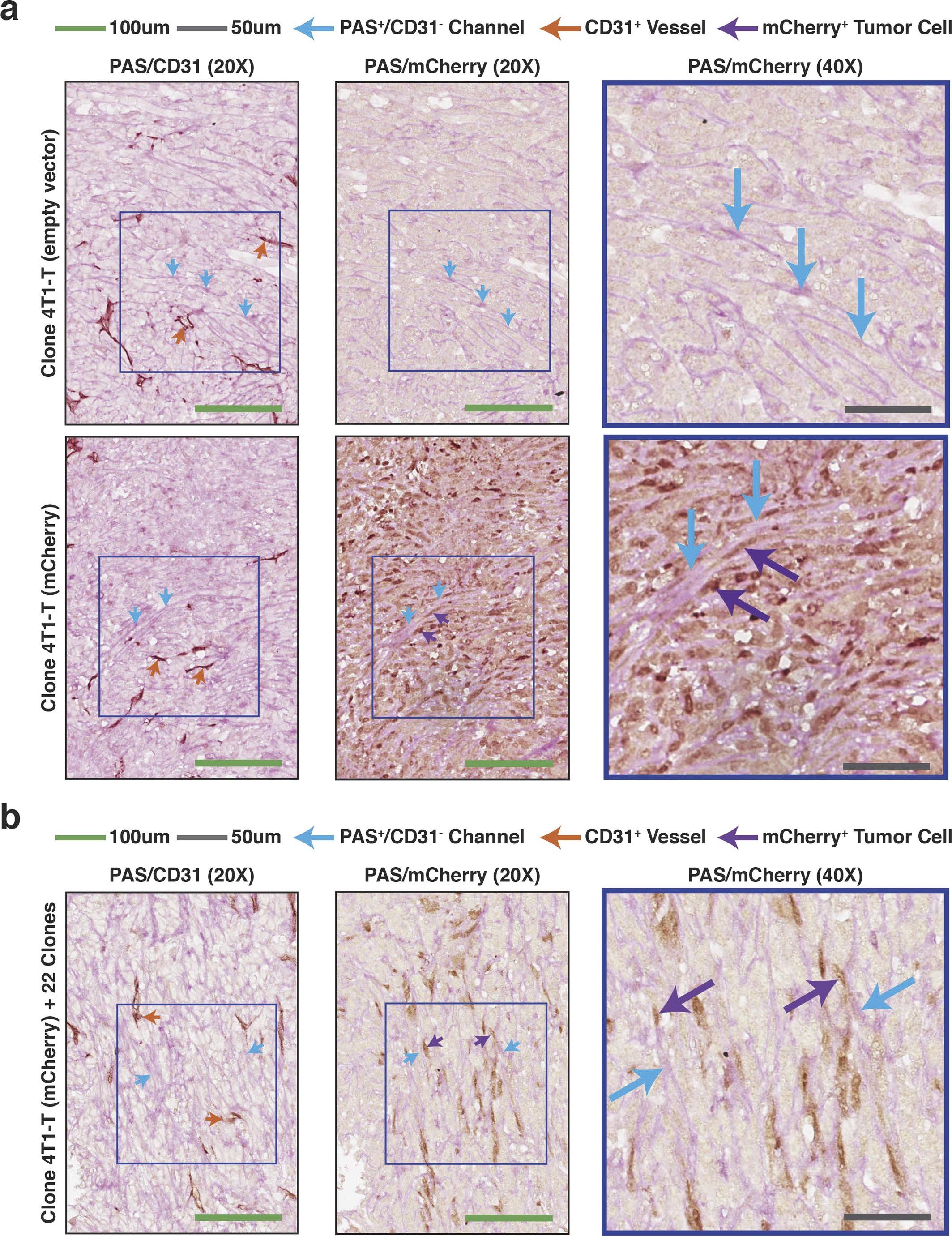 Extended Data Figure 6: Vascular mimicry in 4T1-T and pooled primary tumours.