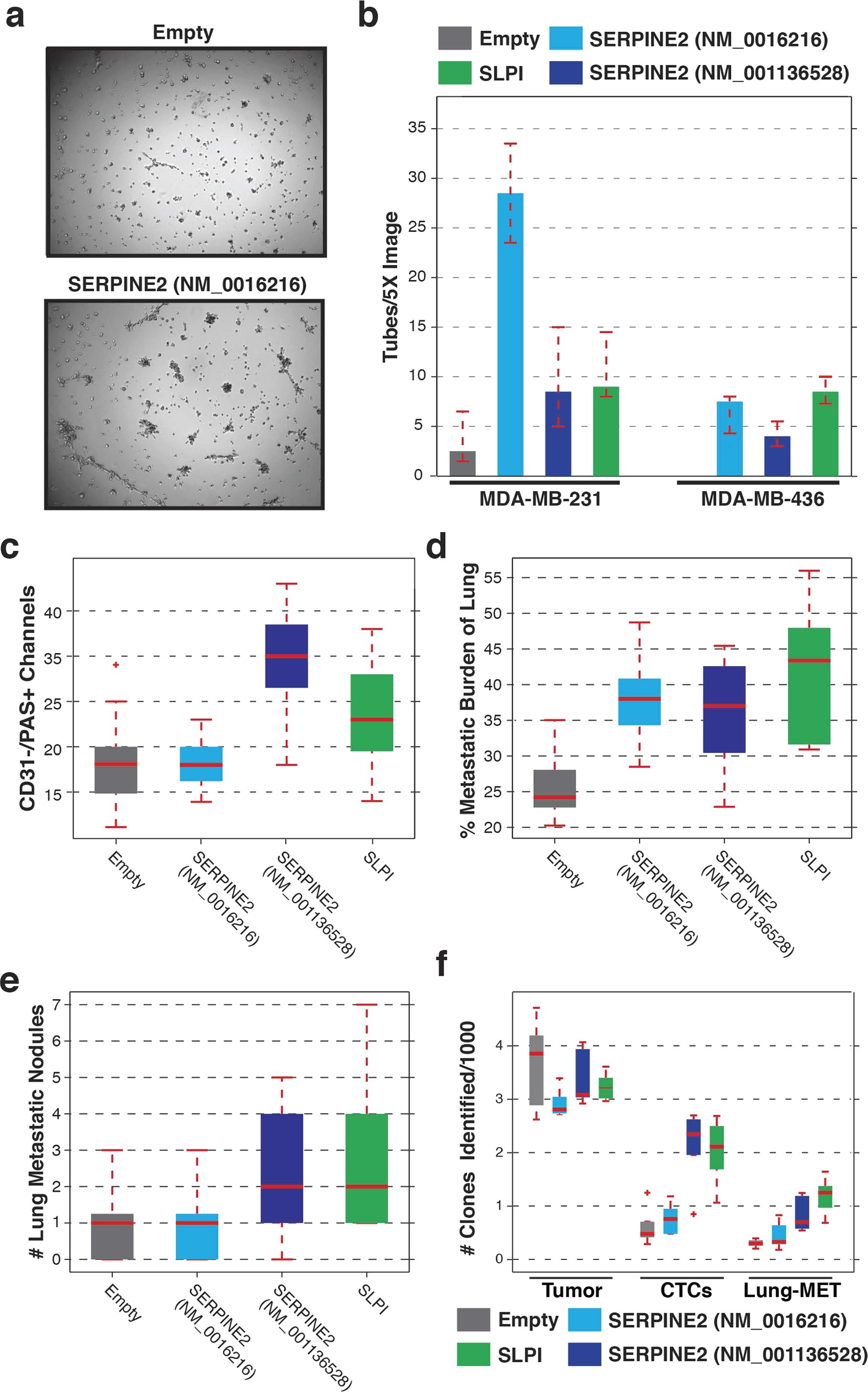Extended Data Figure 8: Overexpression of SERPINE2 and SLPI in human breast cancer cell lines.