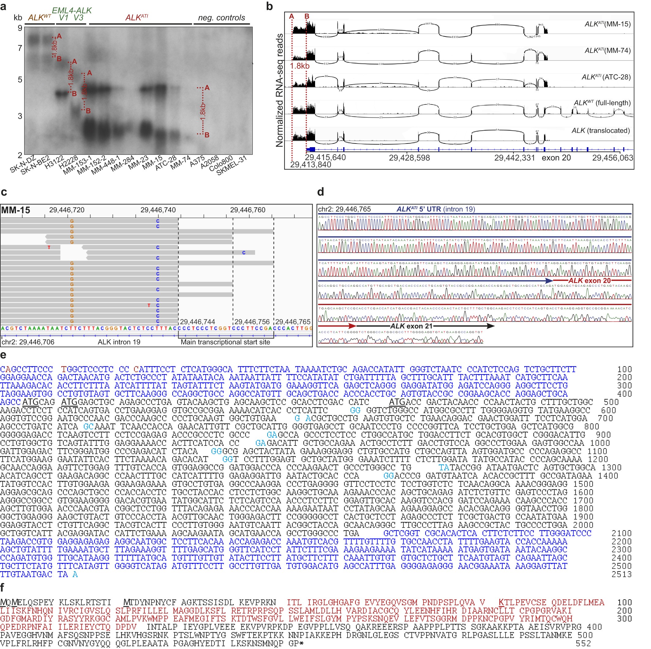 Extended Data Figure 2: Identification of the ALKATI transcript.