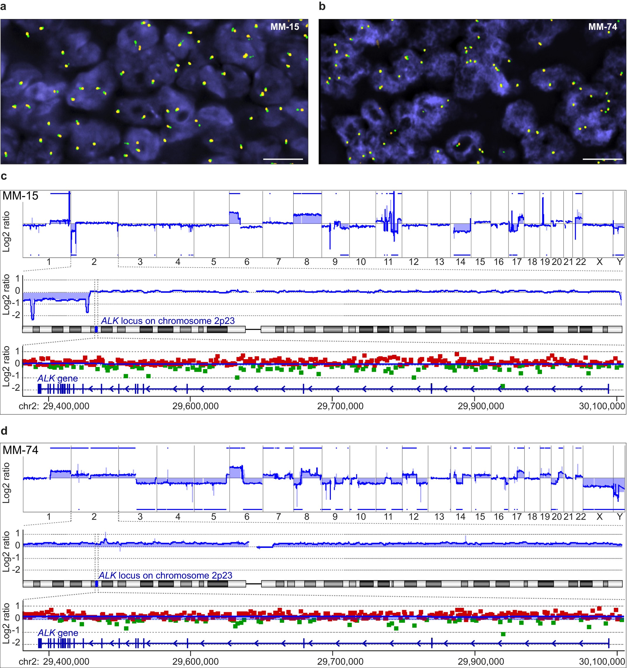 Extended Data Figure 4: ALKATI is transcribed from a genomically intact ALK locus.