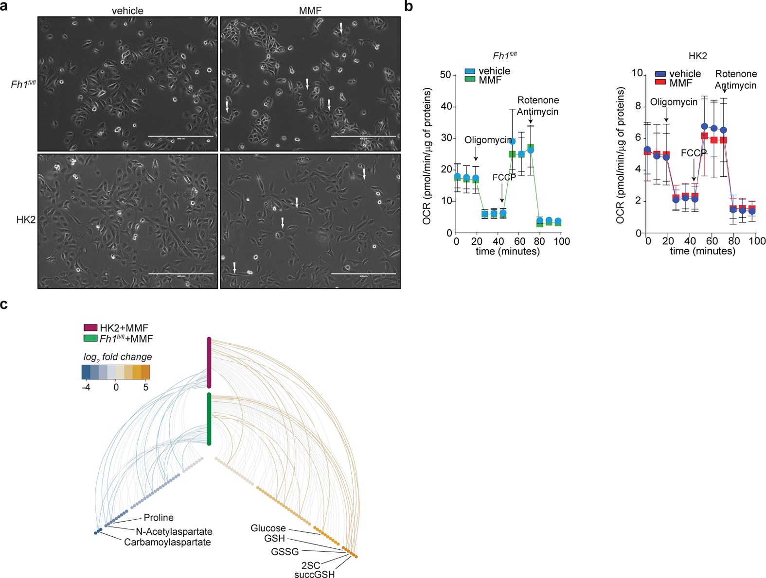 Extended Data Figure 8: MMF triggers EMT in FH-proficient cells.