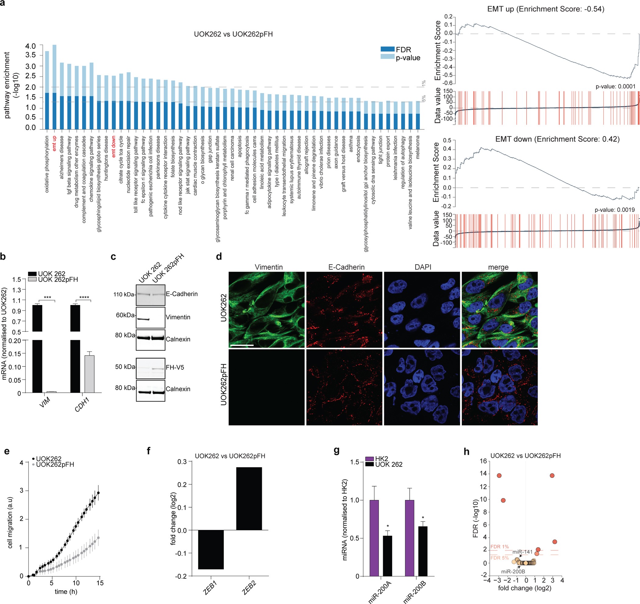 Extended Data Figure 3: EMT signature in UOK262 cells.