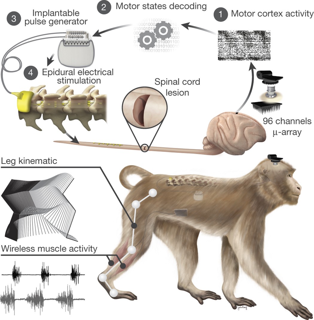 A brain–spine interface alleviating gait deficits after spinal cord injury  in primates | Nature