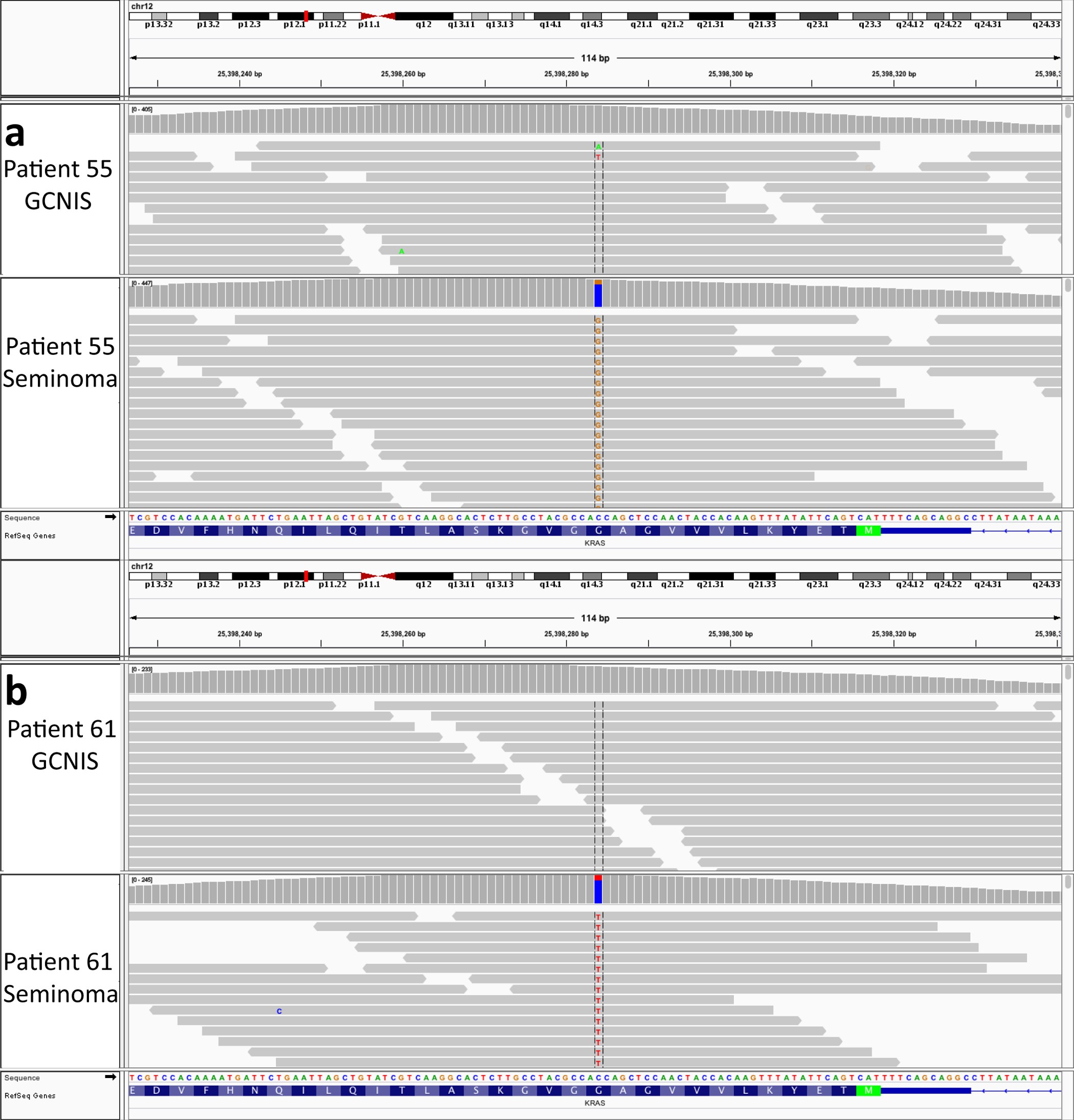 Extended Data Figure 2: Genomic reads for KRAS loci in two patient cases.
