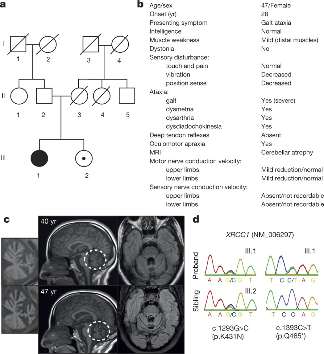 XRCC1 mutation is associated with PARP1 hyperactivation and cerebellar  ataxia | Nature, image size:1050x1148