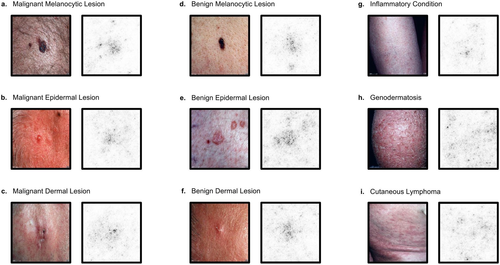 Extended Data Figure 3: Saliency maps for nine example images from the second validation strategy.