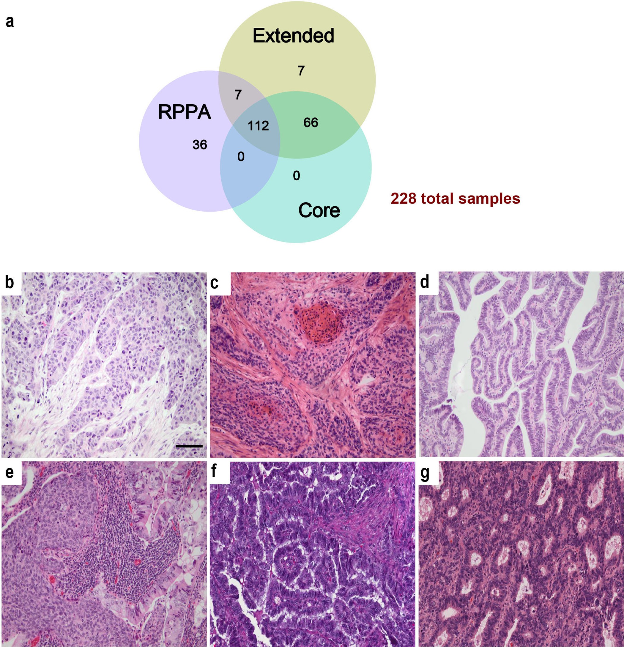 Extended Data Figure 1: Sample sets and histological patterns of cervical cancer.