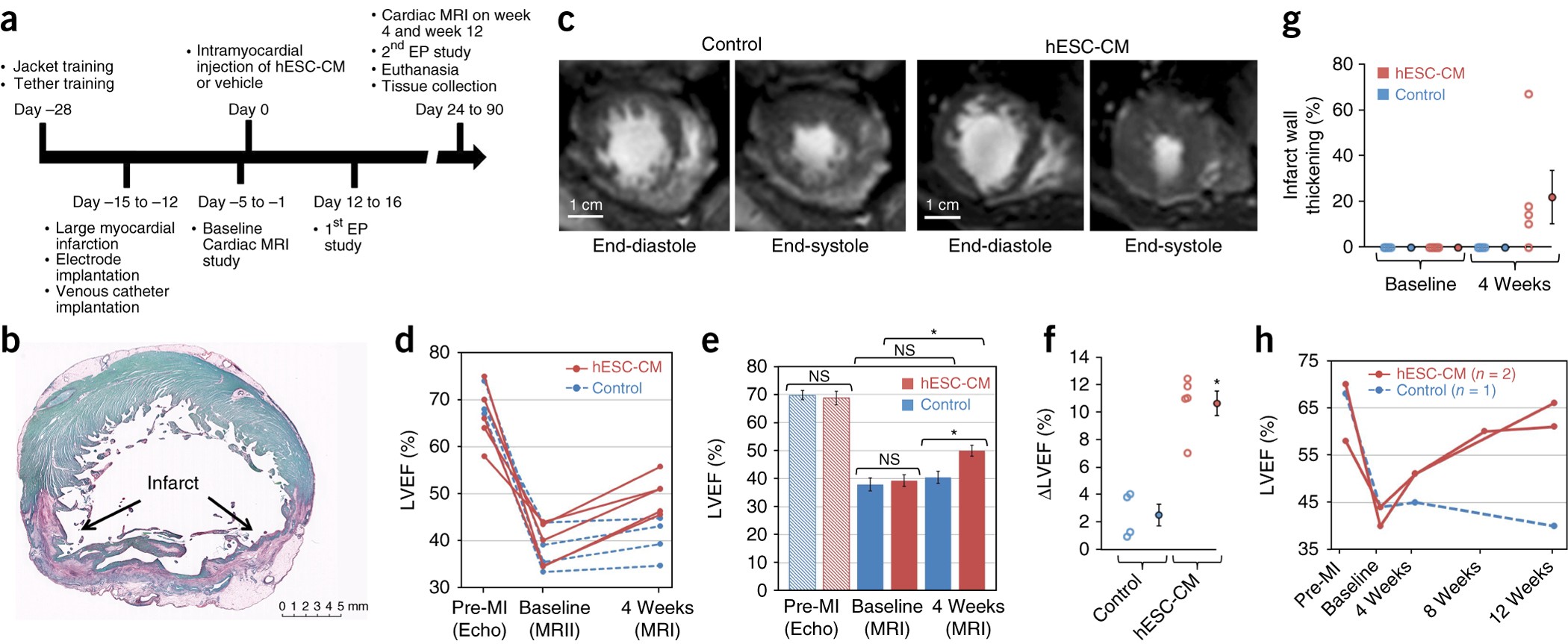 Human Embryonic Stem Cell Derived Cardiomyocytes Restore Function In Infarcted Hearts Of Non Human Primates Nature Biotechnology Human Embryonic Stem Cell Derived Cardiomyocytes Restore Function In Infarcted Hearts Of Non Human Primates Nature Biotechnology