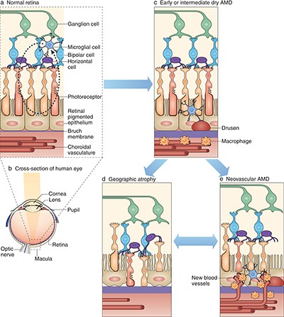 glutathione and macular degeneration Age-related foils drugmakers Master peptide cycling for nourish MG:70mg