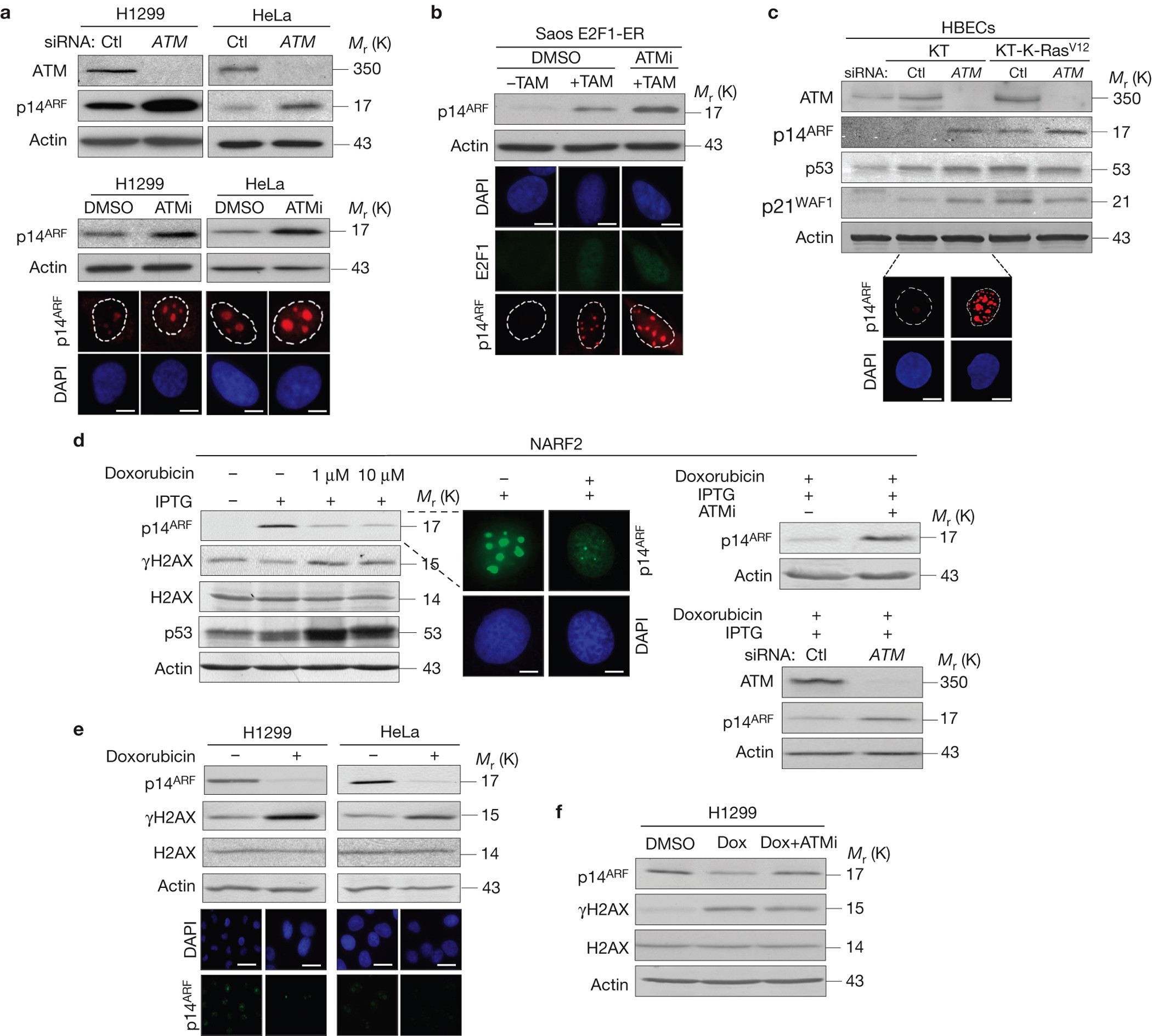 Functional interplay between the DNA-damage-response kinase ATM and ARF  tumour suppressor protein in human cancer | Nature Cell Biology