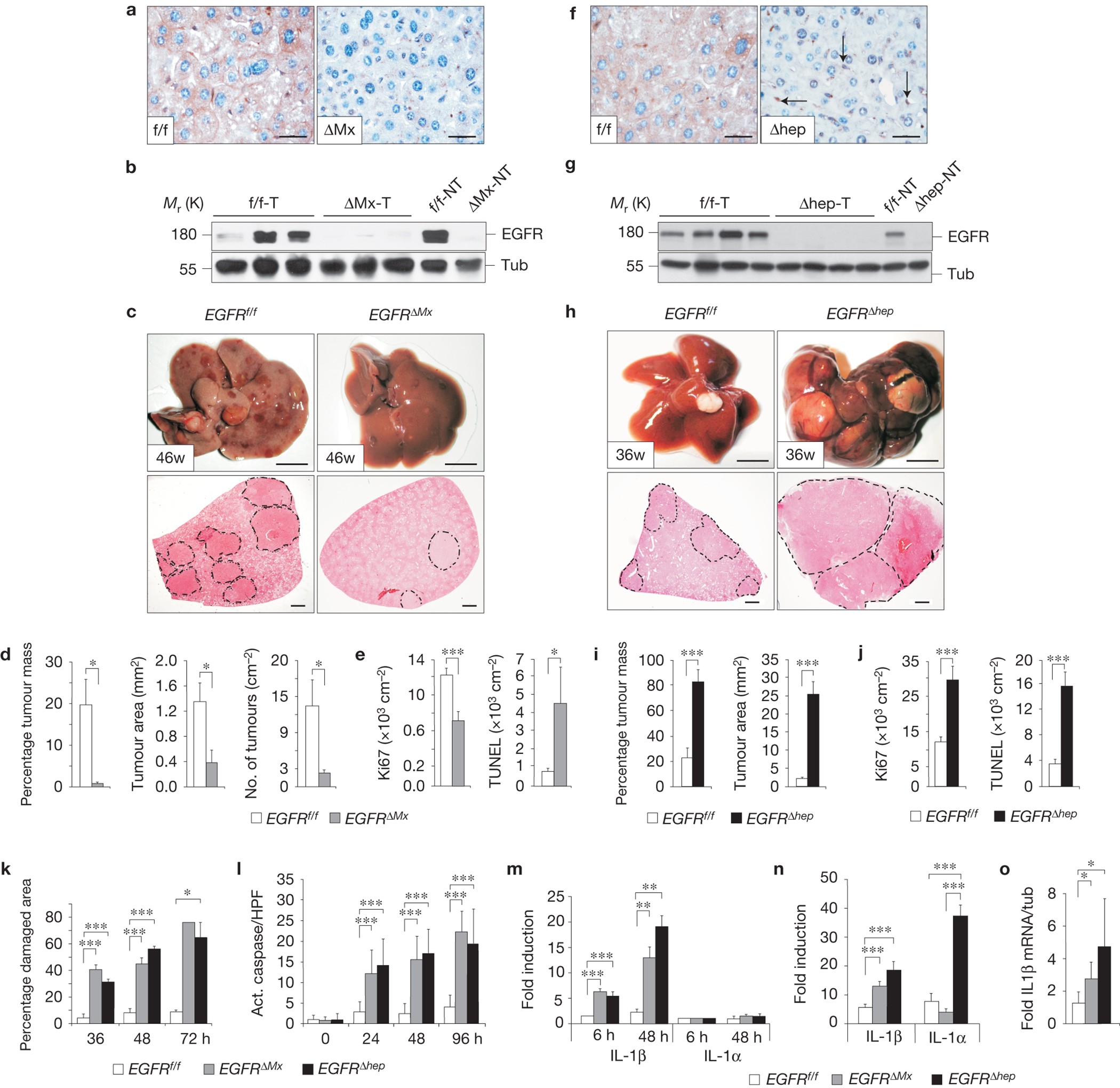 EGFR has a tumour-promoting role in liver macrophages during hepatocellular  carcinoma formation | Nature Cell Biology