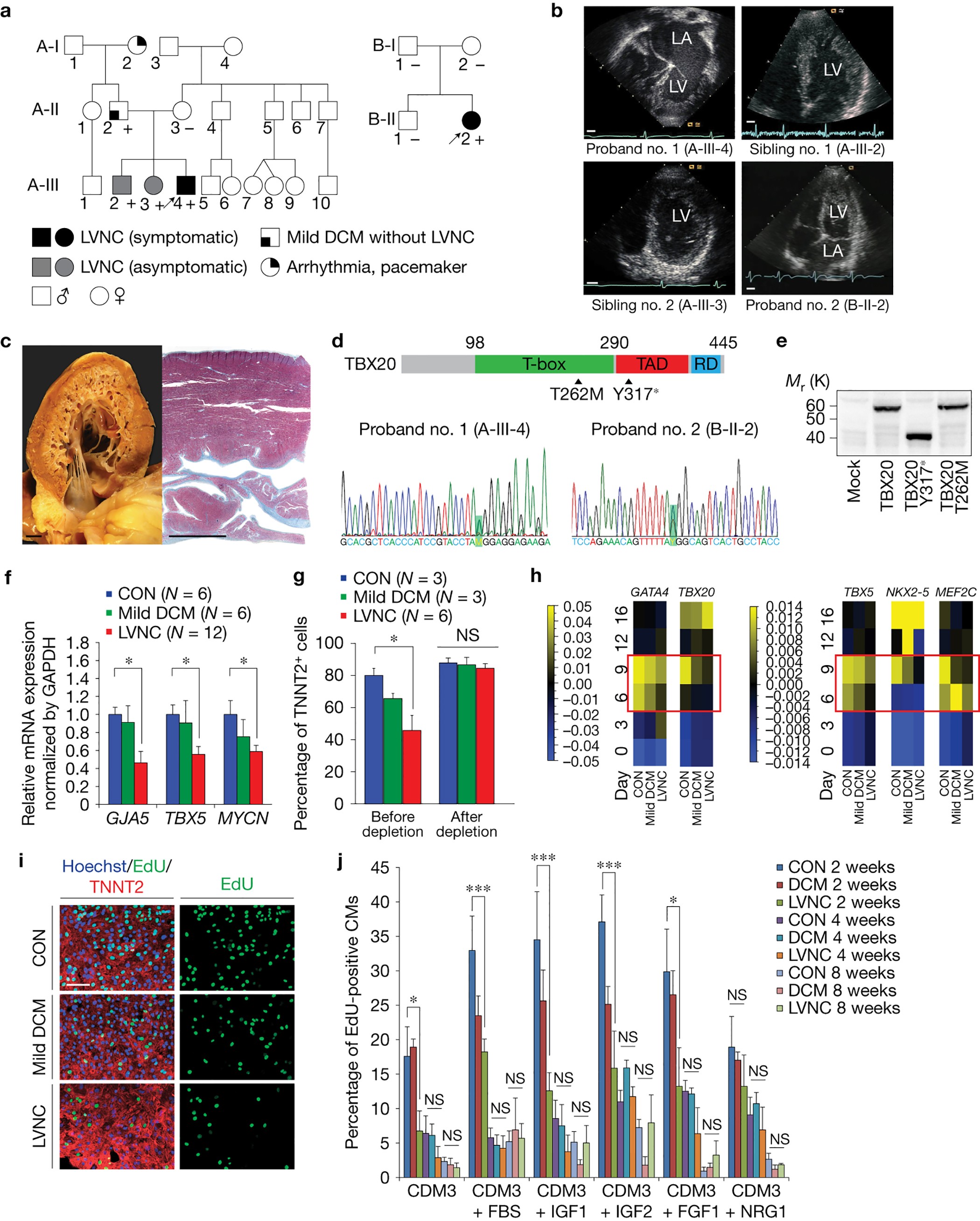 iPSC-derived cardiomyocytes reveal abnormal TGF-β signalling in left  ventricular non-compaction cardiomyopathy | Nature Cell Biology