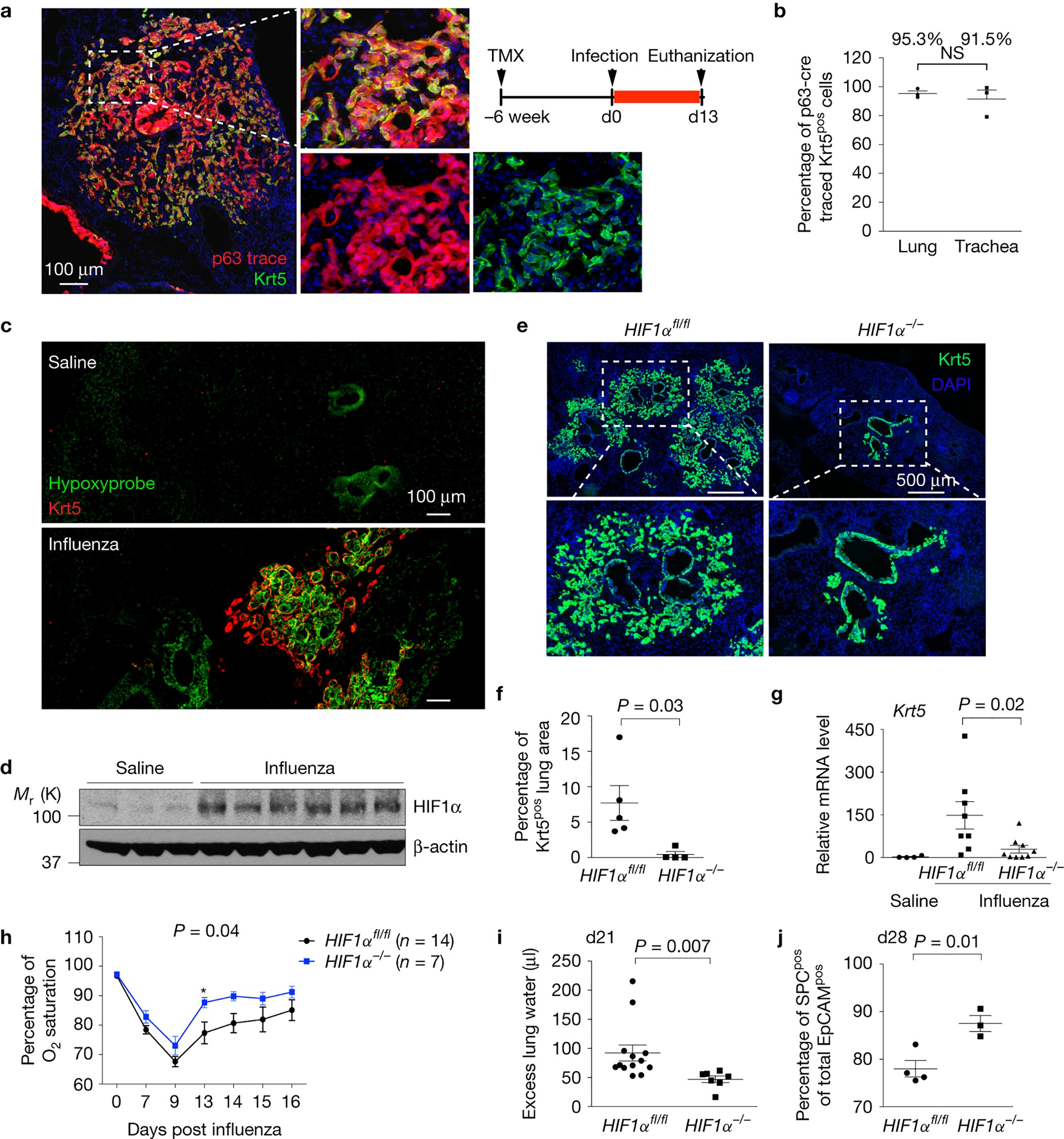 Local Lung Hypoxia Determines Epithelial Fate Decisions