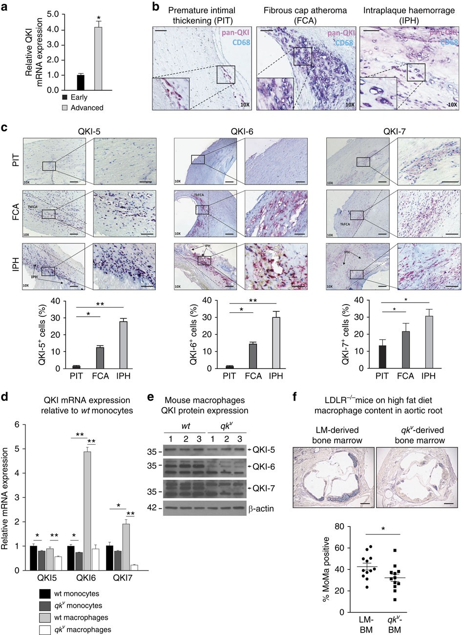 Quaking promotes monocyte differentiation into pro-atherogenic macrophages  by controlling pre-mRNA splicing and gene expression | Nature Communications
