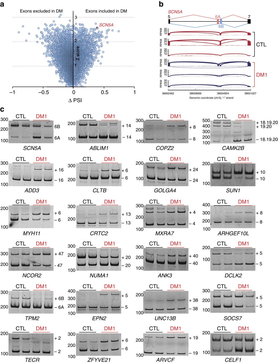 Splicing Misregulation Of Scn5a Contributes To Cardiac - 
