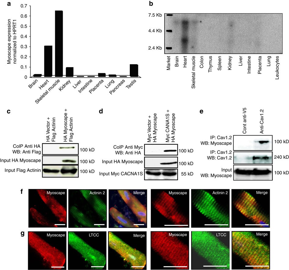 Myoscape Controls Cardiac Calcium Cycling And Contractility Via Regulation Of L Type Calcium Channel Surface Expression Nature Communications