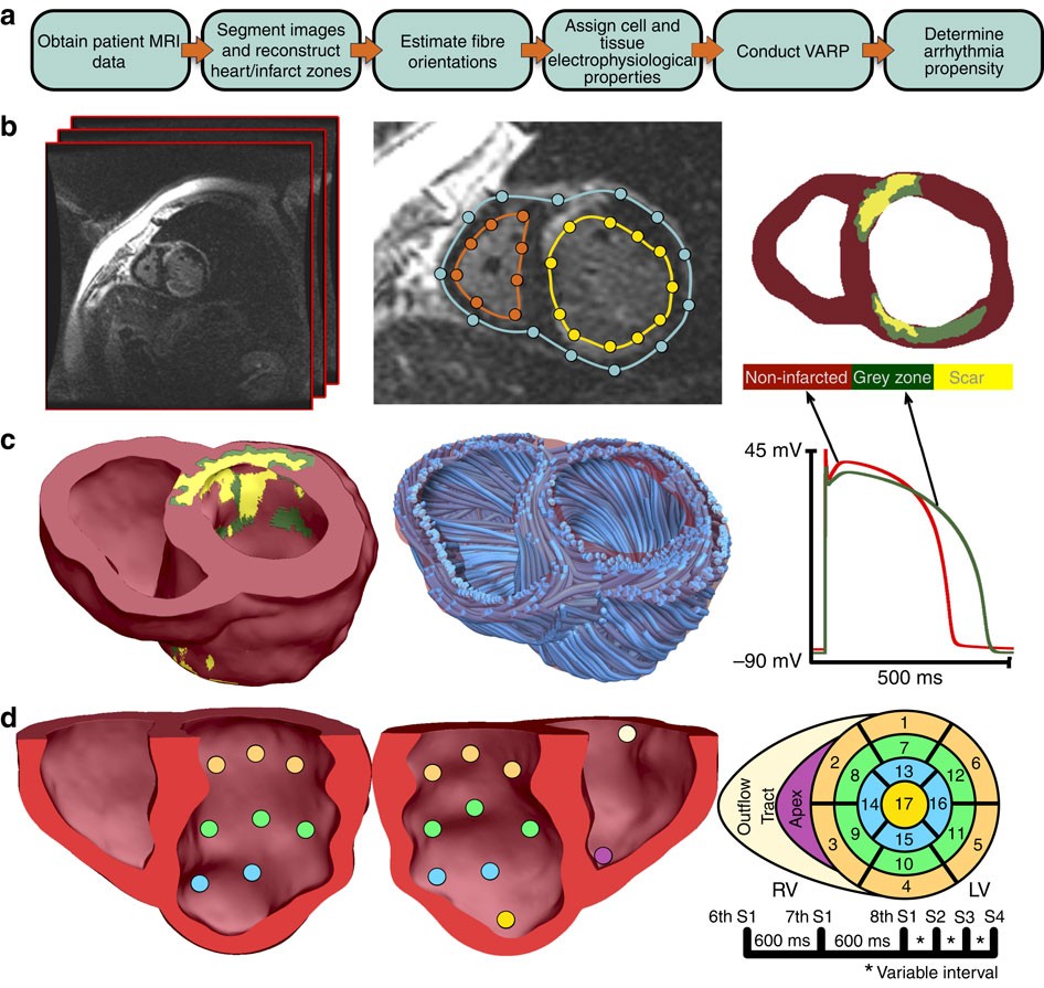 Arrhythmia Risk Stratification Of Patients After Myocardial Infarction Using Personalized Heart Models Nature Communications