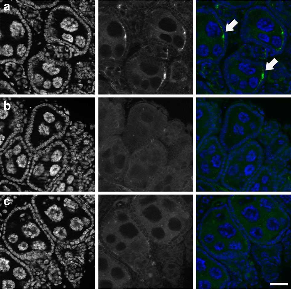 Wolbachia Infections In Natural Anopheles Populations Affect Egg Laying And Negatively Correlate With Plasmodium Development Nature Communications