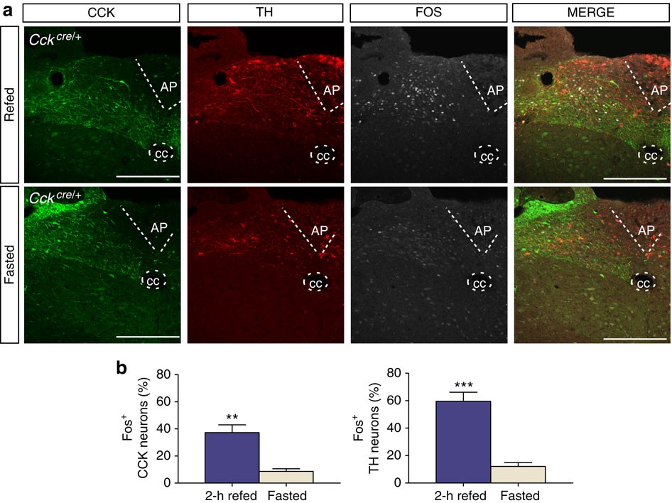 Neighbor-net analysis of Pedicularis section Cyathophora using nrITS