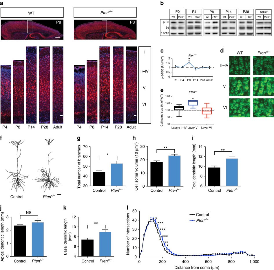 Excess Brain Fluid May Forecast Autism >> Hyperconnectivity Of Prefrontal Cortex To Amygdala Excess Brain Fluid May Forecast Autism >> Hyperconnectivity Of Prefrontal Cortex To Amygdala