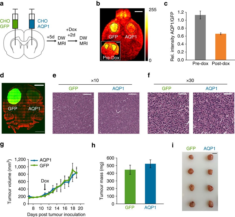 Figure 4: AQP1 enables the imaging of gene expression in intracranial tumour xenografts.