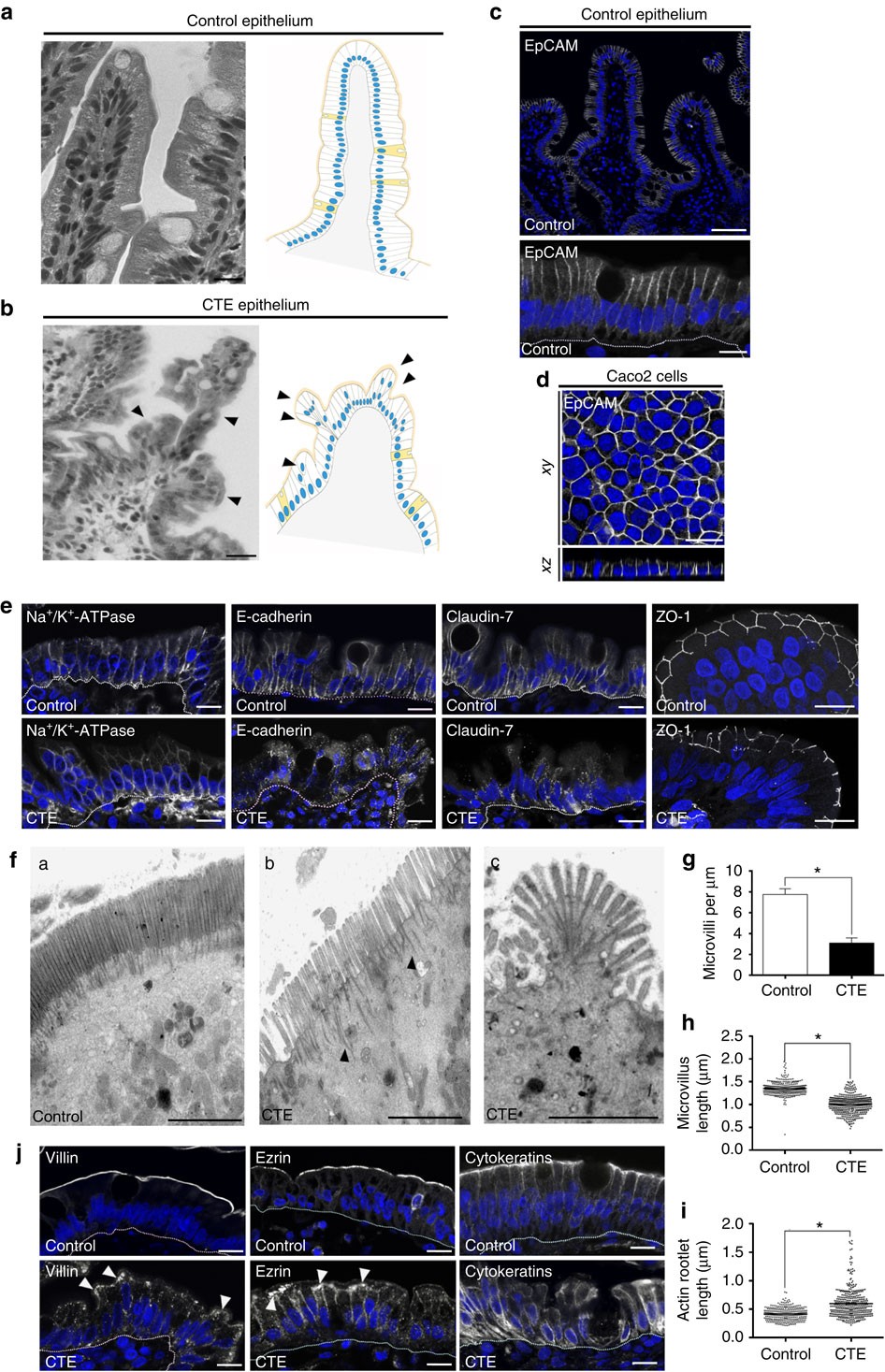 Contractile forces at tricellular contacts modulate epithelial organization  and monolayer integrity | Nature Communications