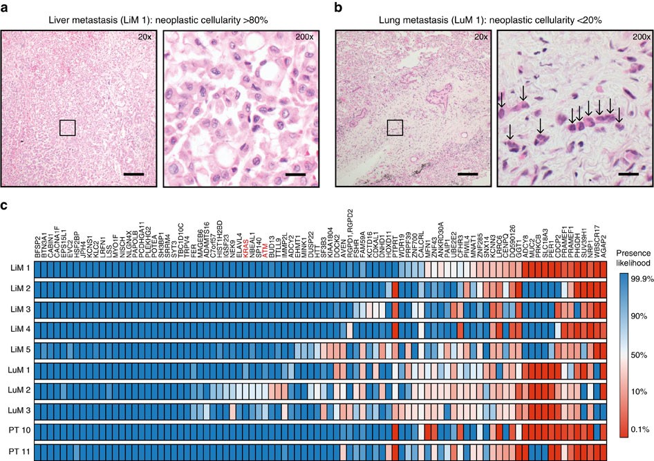 Reconstructing Metastatic Seeding Patterns Of Human Cancers Nature Communications
