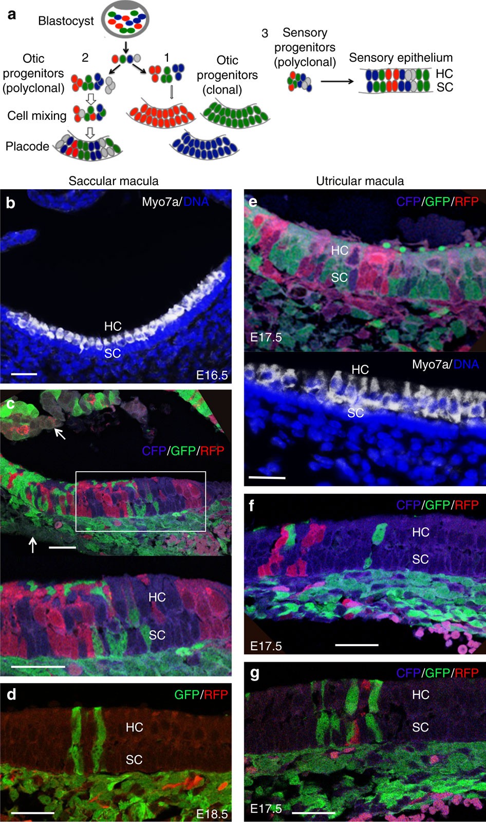 Identification of mouse cochlear progenitors that develop hair and  supporting cells in the organ of Corti | Nature Communications