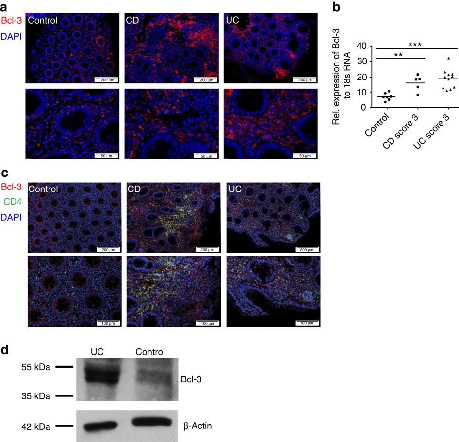 Elevated Levels Of l 3 Inhibits Treg Development And Function Resulting In Spontaneous Colitis Nature Communications Elevated Levels Of l 3 Inhibits Treg Development And Function Resulting In Spontaneous Colitis Nature Communications