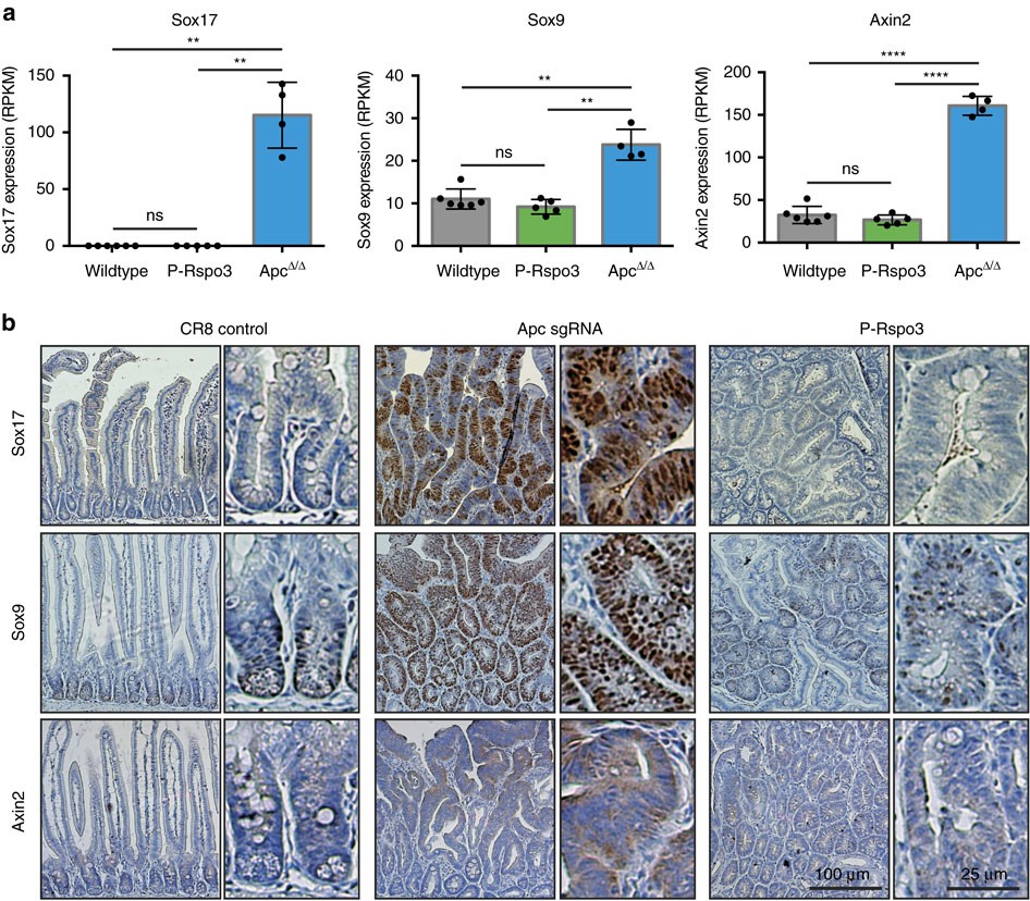 Figure 5: P-Rspo3 tumours are molecularly distinct from Apc-mutant tumours.