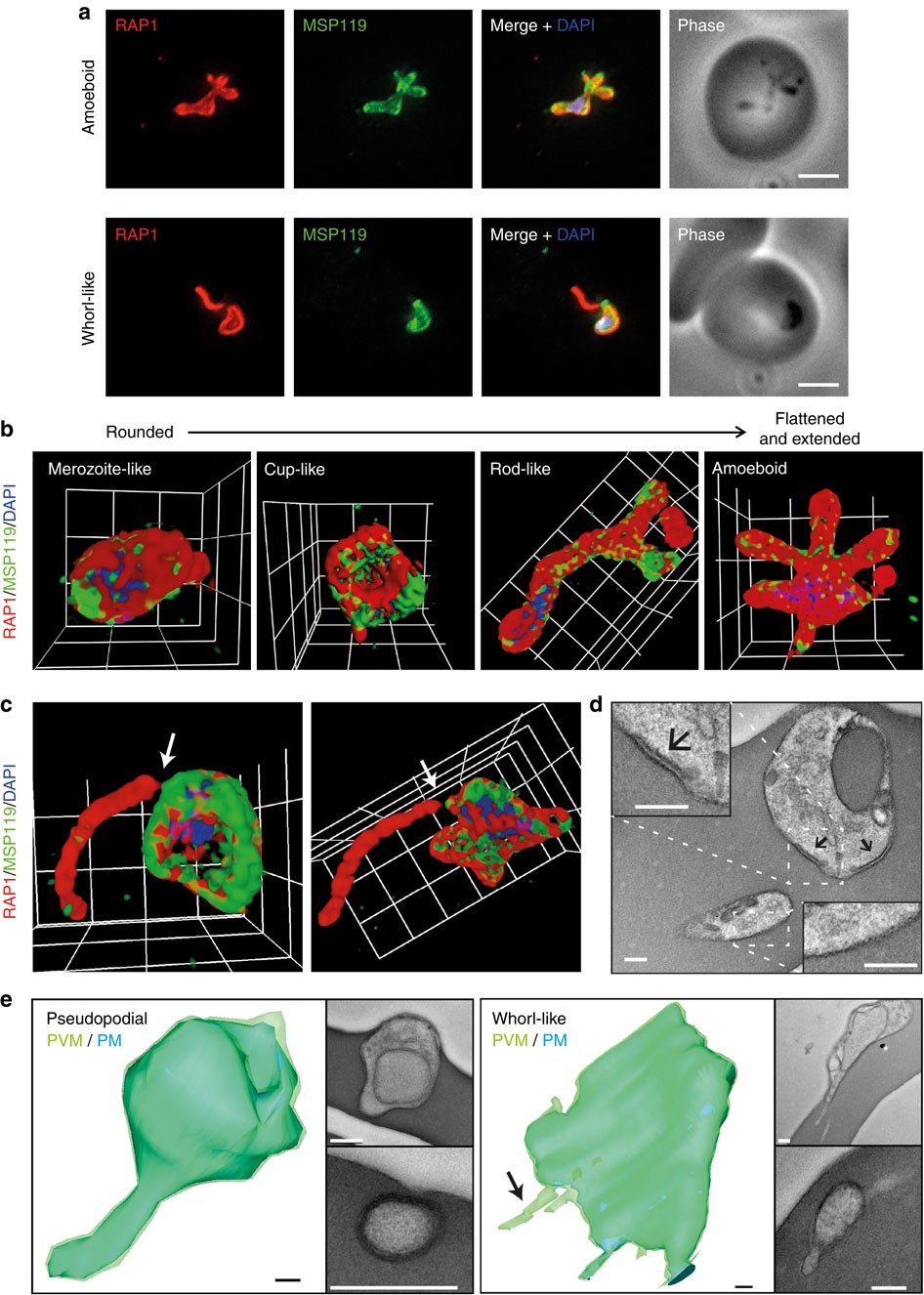 Spatial association with PTEX complexes defines regions for effector export  into Plasmodium falciparum-infected erythrocytes | Nature Communications