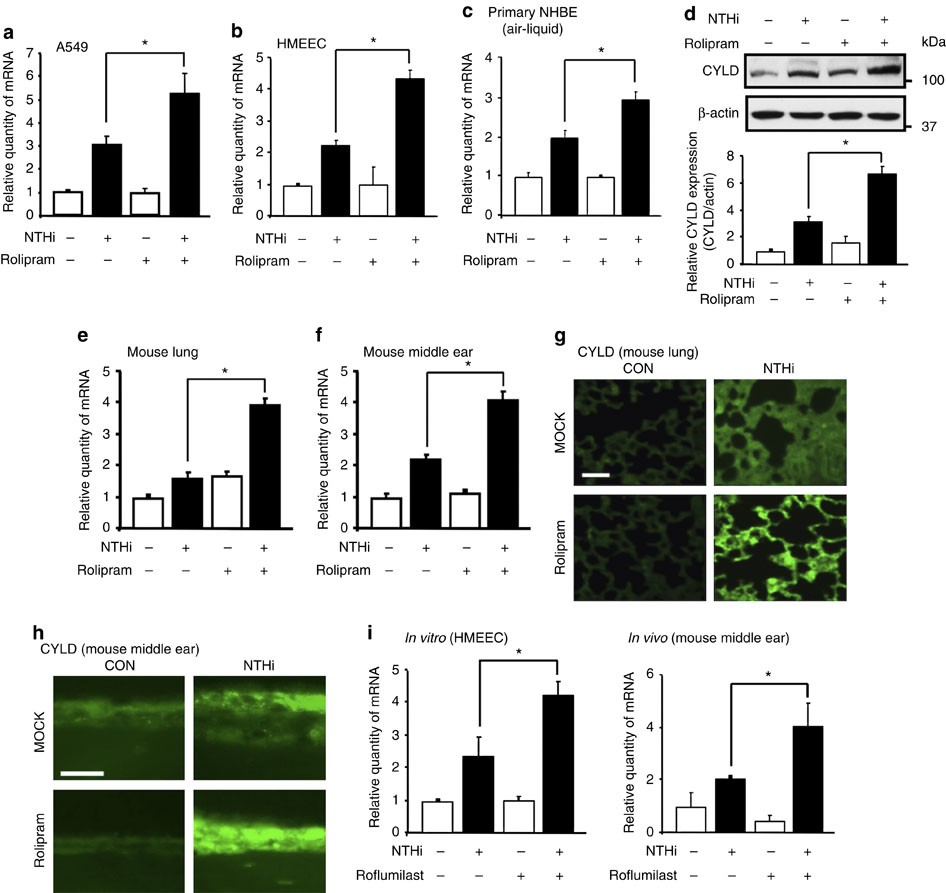 greb Nedsænkning tolv Inhibition of PDE4B suppresses inflammation by increasing expression of the  deubiquitinase CYLD | Nature Communications