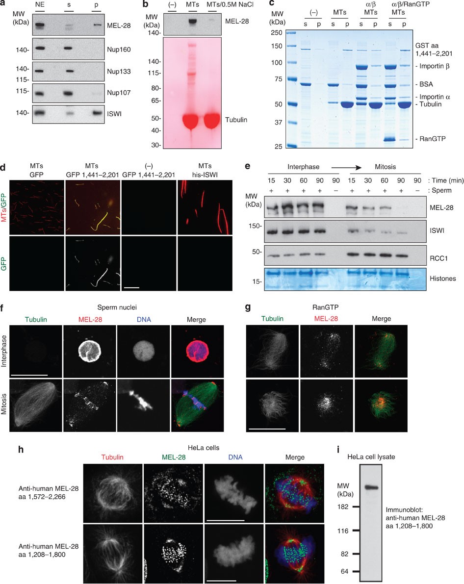 The Nucleoporin MEL-28 Promotes RanGTP-Dependent Γ-Tubulin.
