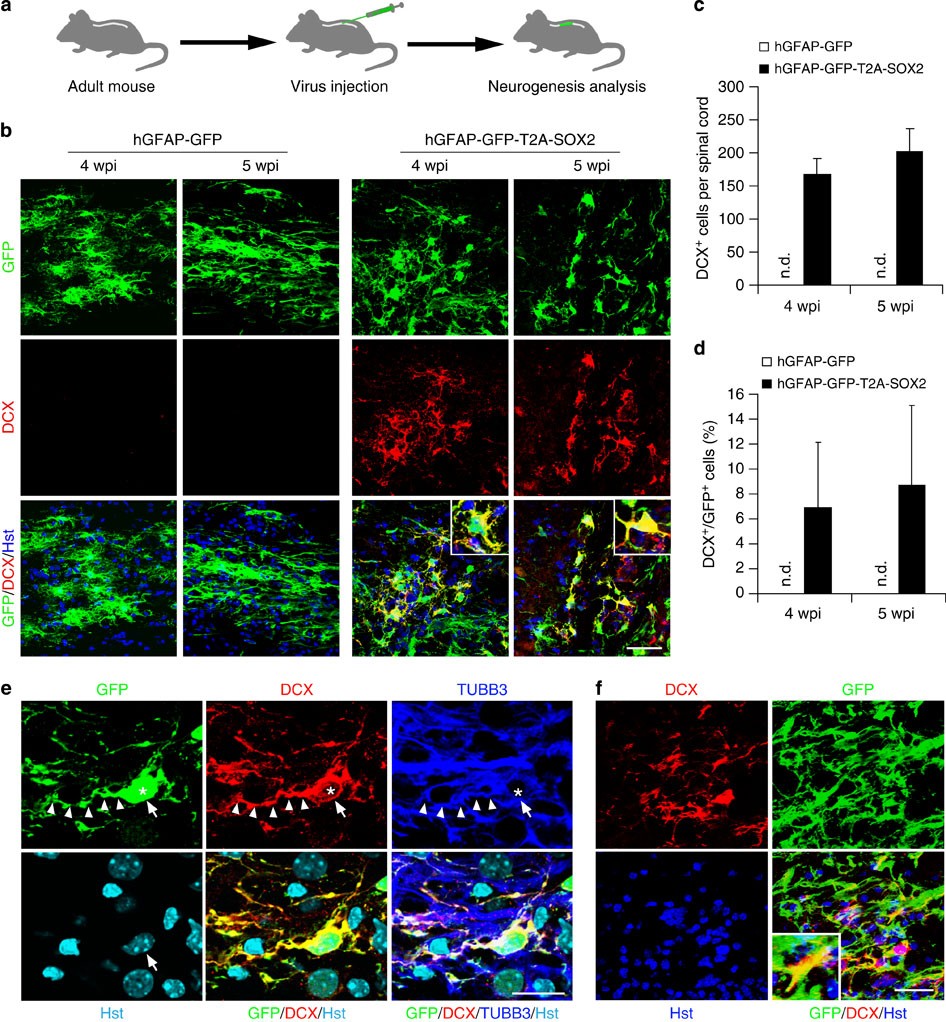 Figure 1: Induction of DCX+ cells in the adult mouse spinal cord.