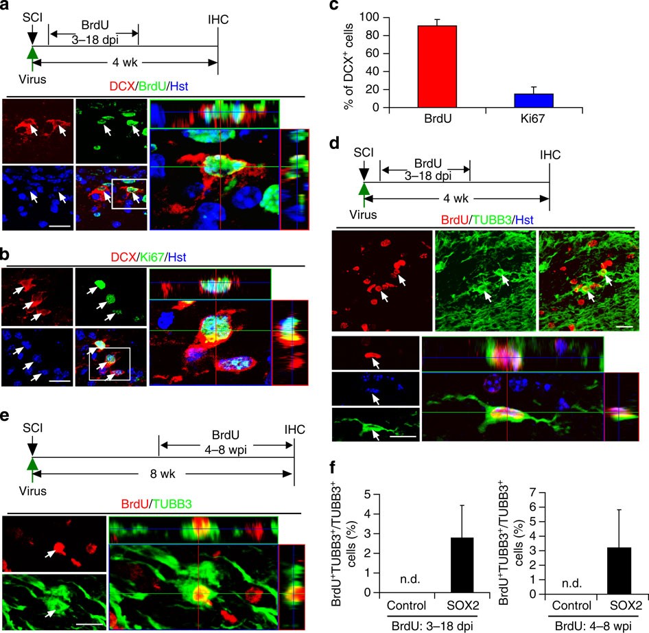 Figure 5: Cell proliferation during SOX2-induced neurogenesis in the adult spinal cord.