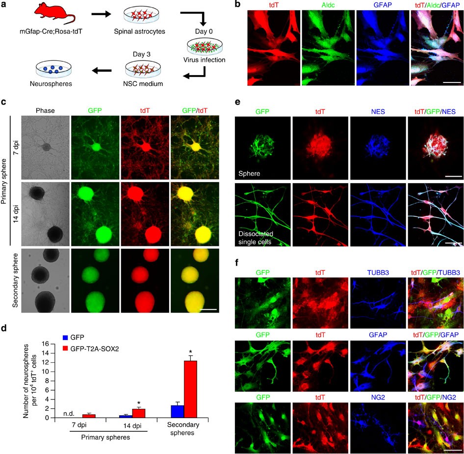 Figure 6: Induction of NSCs from spinal astrocytes by SOX2 in culture.